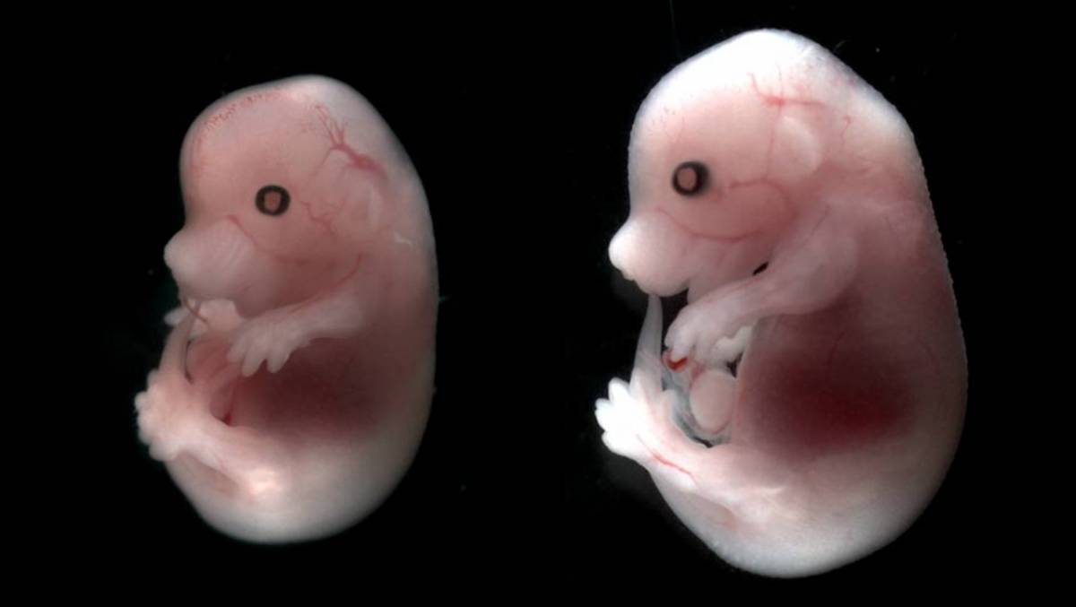 Fasi embrionali di un topo