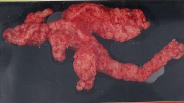 Cheetozard patatina cover