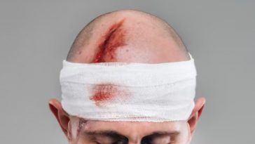 Un uomo ferito con la testa fasciata