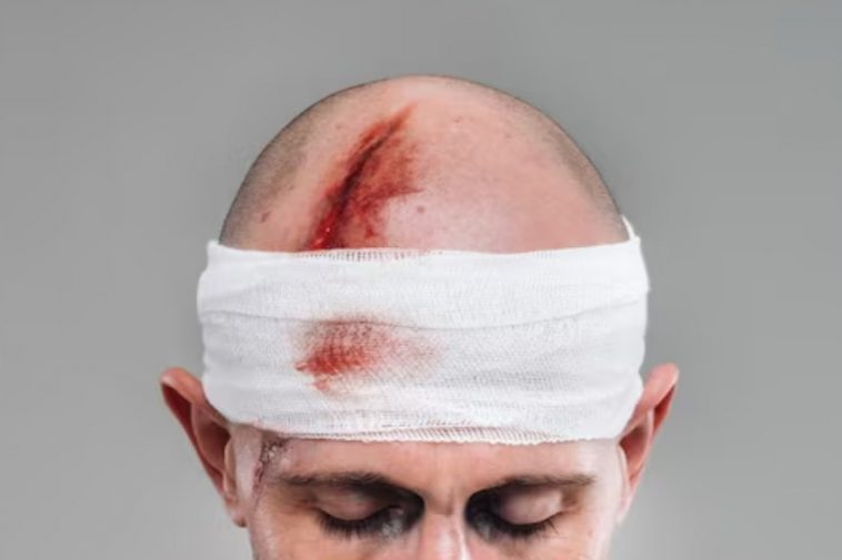 Un uomo ferito con la testa fasciata