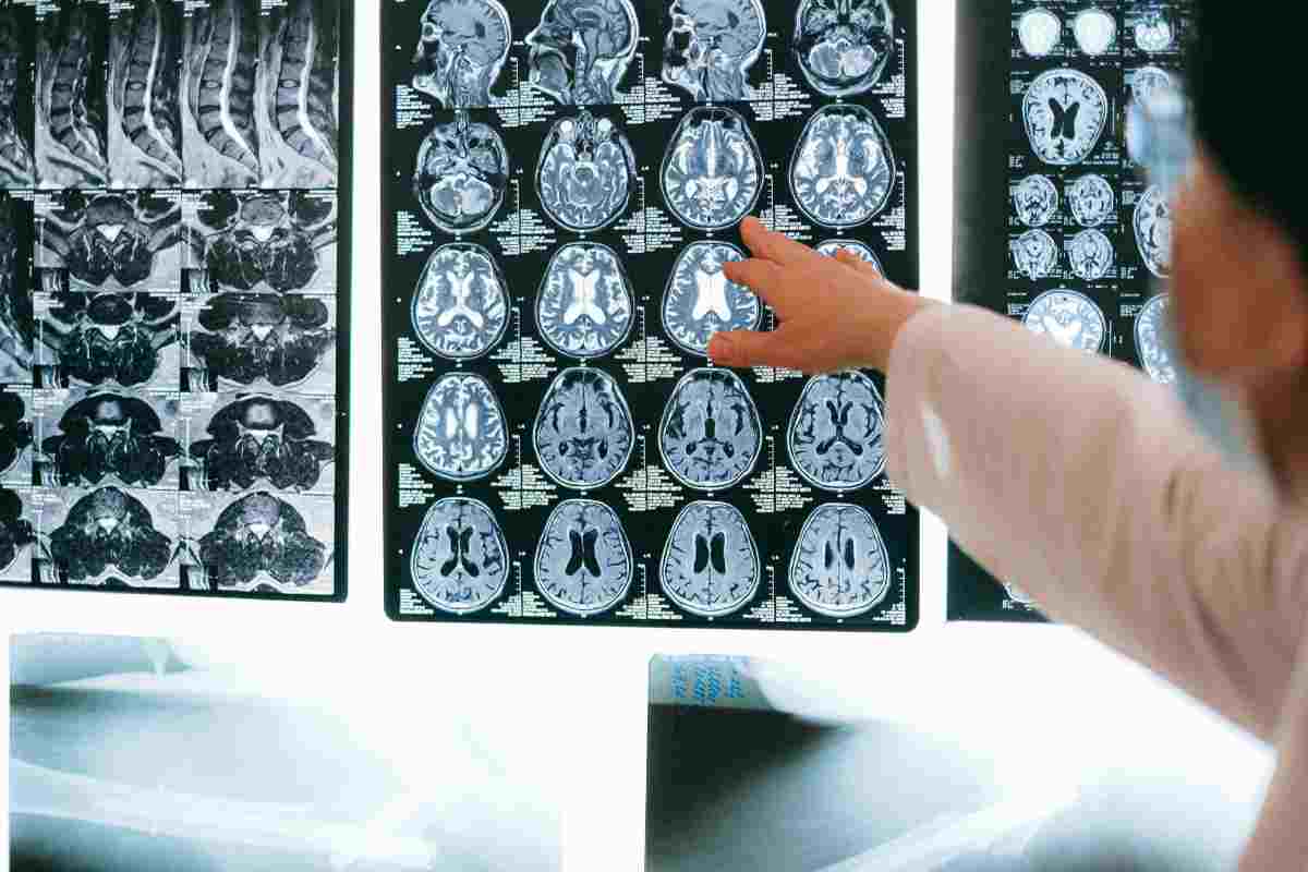 I risultati di un encefalogramma in esposizione