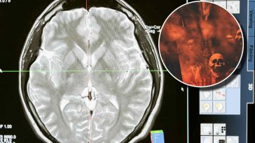 Un cervello in un EEG e, in evidenza, delle immagini demoniache con teschi