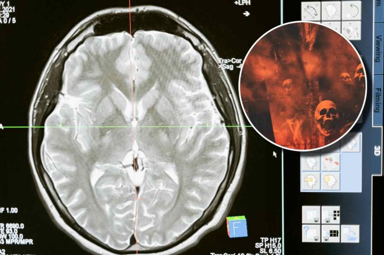 Un cervello in un EEG e, in evidenza, delle immagini demoniache con teschi